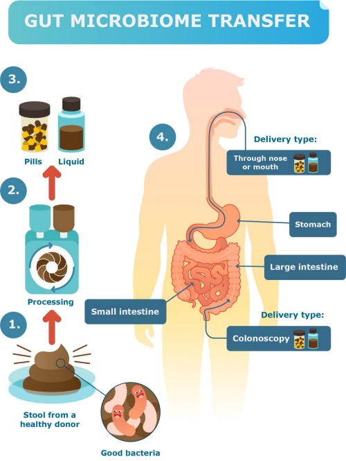 Diagram detailing gut microbiome transfer.